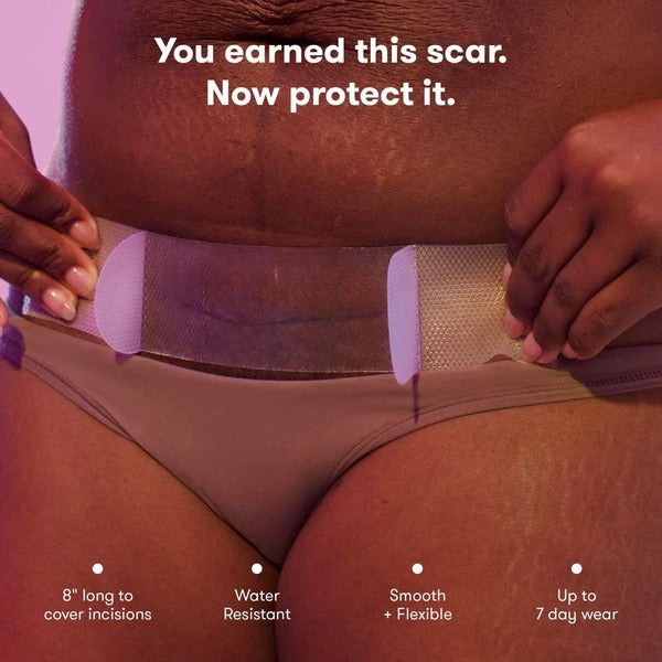 C-Section Silicone Scar Patches